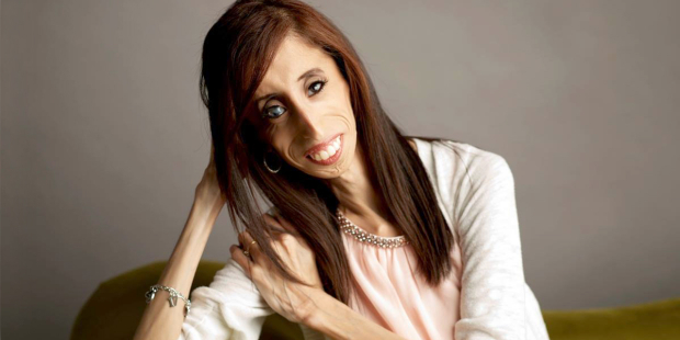 lizzie-velasquez